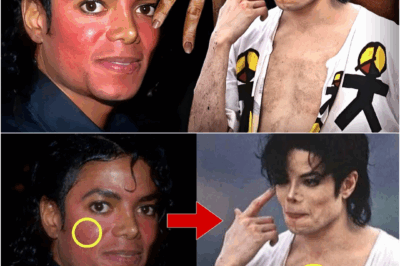 A DEEP Analysis of Michael Jackson’s Changing Skin Tone!
