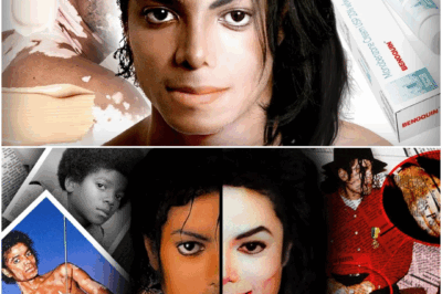 The REAL Reason Why Michael Jackson Turned His Skin White?