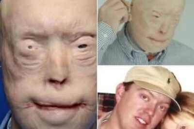 Firefighter suffers third-degree burns, this is him 7 years later