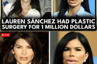 Lauren Sanchez Spent $1 Million on Plastic Surgery… and the Results Shocked Everyone! 👑