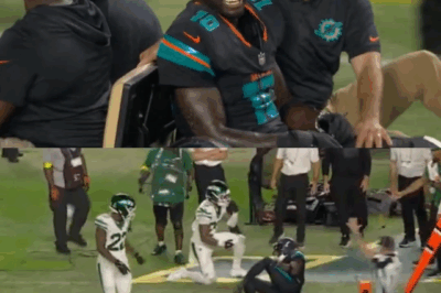 This injury, far worse than a dislocated knee cap, often comes with multiple ligament tears. Not good.