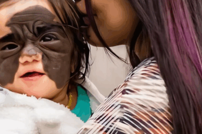 They Called My Daughter a Monster Because of Her “Batman Face” — But What Happened Next Turned Our Pain Into a Miracle