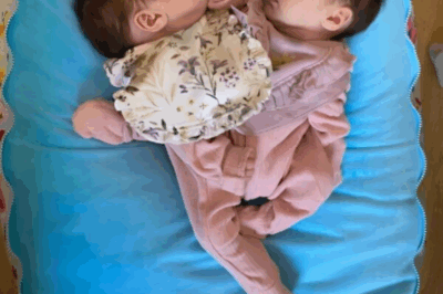 Part1_Doctors Performed an Impossible 18-Hour Surgery to Separate Conjoined Twins—Three Years Later Their Transformation Leaves Everyone Speechless