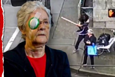 Elderly Seattle Woman Seriously Injured in Random Daylight Attack by Repeat Offender